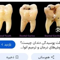 دندان
