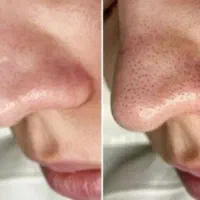 تخفیف ویژه|خدمات آرایشگری و زیبایی|کاشان, ولیعصر|دیوار