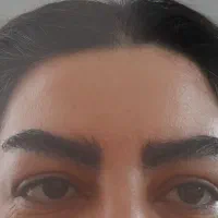 جشنواره ویژه کاشت مو و ابرو طبیعی و دائمی