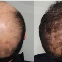 موب خودرا زیبا کنید در عرض 20 روز