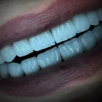 کامپوزیت،لمینیت اقساط 2 تا 12 ماهه|خدمات آرایشگری و زیبایی|بومهن, |دیوار