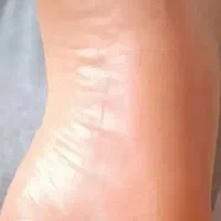 کف سابی پا و کاشت ناخن و فشیال و پاک‌سازی