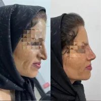 مرکزتخصصی لیفت بانخ و کانتورینگ صورت