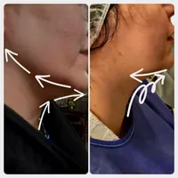 مرکز تخصصی لیپوساکشن غبغب|خدمات آرایشگری و زیبایی|تهران, پاسداران|دیوار