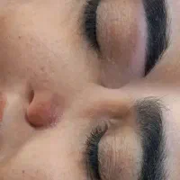 اصلاح ابرو تخصصی