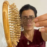 پکیج حرفه‌ای ریزش مو