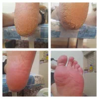 اسپا وی ای پی تضمینی ۳۰۰ هزارتومان|خدمات آرایشگری و زیبایی|شیراز, شهرک ولیعصر|دیوار