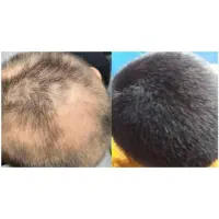 نوشیدنی طراوت مو