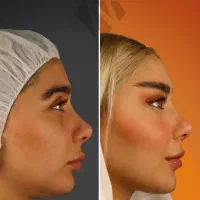 عمل بینی و جراحی لیپوساکشن با تیم پزشکان|خدمات آرایشگری و زیبایی|تهران, فلسطین (میدان انقلاب)|دیوار