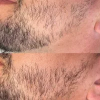 تضمین کیفیت