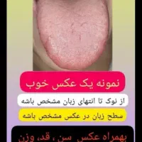 تشخیص بیماریها فقط و فقط از روی تحلیل زبان|خدمات آرایشگری و زیبایی|آستانه اشرفیه, |دیوار
