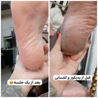 کاشت ناخن و کفسابی پا و اکستنشن مژه فشیال درغرب