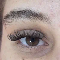 کاشت مژه