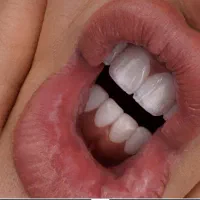 آخرین جشنواره لمینت