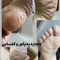 خدمات کفسابی و پدیکور (درمانی و زیبایی )پا|خدمات آرایشگری و زیبایی|مشهد, وکیل‌آباد|دیوار