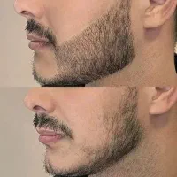 پیازچه هات تنبل شدن