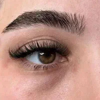 کاشت مژه هیدن ۲۳۰