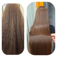 پروتئین وبوتاکس روبذارکنار.تکنیک 2S جایگزین همشونه