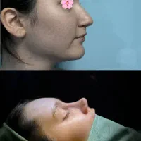 فرصت طلایی عمل بینی دکتر سلیمی نژاد (۳۸ میلیون)