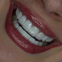 کامپوزیت ، لمینیت با بهترین کیفیت و اقساط (تهران)|خدمات آرایشگری و زیبایی|اراک, |دیوار