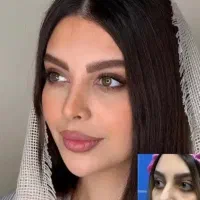 عمل بینی رینوپلاستی فقط ۴۰ تومن (با تخفیف ویژه)