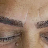 کاشت میکرو باقلم و دستگاه