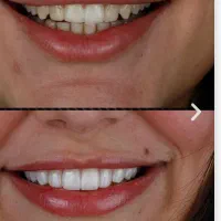 نیازمند متخصص