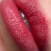 شیدینگ لب بدون درد و خونریزی