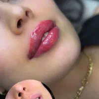 تزریق فیلر کرم پودر دائم مزونیدلینگ و ...