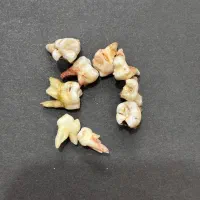 دندان شیری و دائمی برای دانشجویان|پزشکی|بیرجند, |دیوار