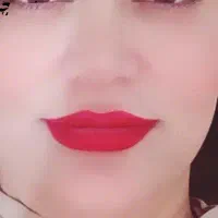 مزو، بوتاکس، فیلر، ژل لب