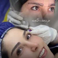 نانو گرافت کاشت دائمی ابرو - شرایط اقساط