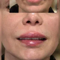 پوست،مو،زیبایی،دکتر تدین زاده|خدمات آرایشگری و زیبایی|کرج, فاز ۳ گوهردشت|دیوار