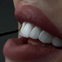 دندان پزشکی/لمینیت/ارتودنسی/کامپوزیت/ایمپلنت|خدمات آرایشگری و زیبایی|مشهد, چهارچشمه|دیوار