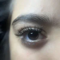 کاشت مژه