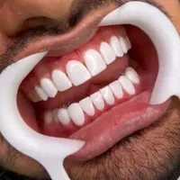 مدل کامپوزیت دندان|خدمات آرایشگری و زیبایی|تهران, شهر زیبا|دیوار