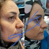 پکیج لاغری و چاقی صادراتی و ضد لک های پوستی|آرایشی، بهداشتی، درمانی|قزوین, |دیوار