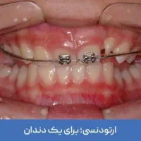 دندون پزشکی که ارتودنسی کنه میشناسین