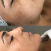 درمان مشکلات پوستی وپاکسازی صورت بطور تخصصی