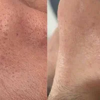 فشیال وپاکسازی تخصصی|خدمات آرایشگری و زیبایی|نورآباد ممسنی, |دیوار