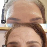 کرم بوتاکس بیوممتیک‌ اصل نمایندگی