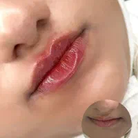 جشنواره تخفیف ویژه فیلربوتاکس انزیم وقت فوری|خدمات آرایشگری و زیبایی|کرج, گوهردشت|دیوار