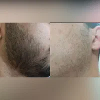 استایل خاصتر با ریش پرتر