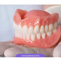 دندان مصنوعی(دست دندان کامل)