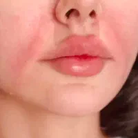 ارائه خدمات تخصصی ژل و بوتاکس|خدمات زیبایی و سلامت|شیراز, فرهنگ شهر|دیوار