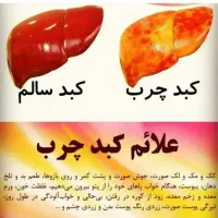 مشکلات کبدت رو تخصصی درمان کن