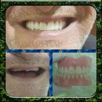 ساخت دندان مصنوعی باکیفیت وضمانت|خدمات آرایشگری و زیبایی|نهاوند, |دیوار