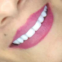 دندانسازی مظفری (با مجوز رسمی )دندان طرح لبخند