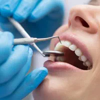 دوره دستیار دندانپزشکی با مدرک دیپلم وبالاتر|خدمات آموزشی|شهرکرد, |دیوار