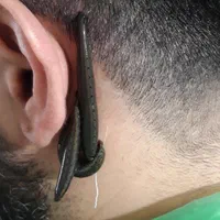 حجامت،فصدخون،زالو درمانی،طب سنتی|خدمات آرایشگری و زیبایی|تهران, تهرانسر شمالی|دیوار